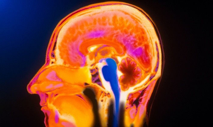 How to teach… the brain | Saul&Partners